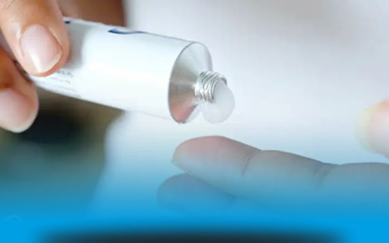 درمان کیست مویی