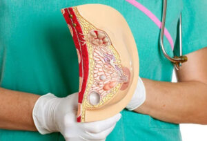 لکه‌های سفید روی سینه؛ نشانه چیست و چه باید کرد؟