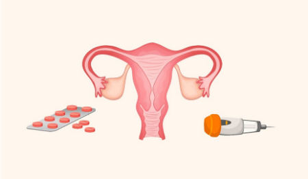 کاهش ذخیره تخمدان, آزمایش ذخیره تخمدان