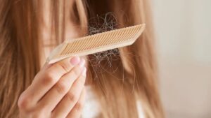 ۵ علامت مهم ریزش مو استرسی که باید بشناسید