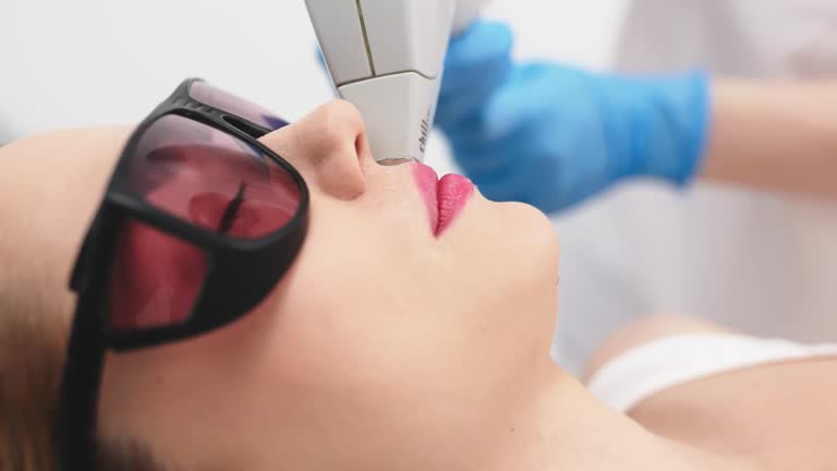 لیزر موهای زائد