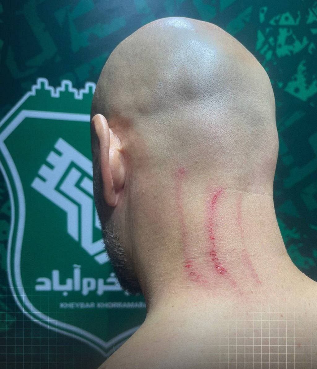 ادعای باشگاه استقلال: ضرب و شتم مربی آبی‌ها پس از پایان بازی