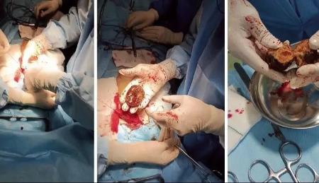 خرمالو،اخبار پزشکی،خبرهای پزشکی خرمالو،اخبار پزشکی،خبرهای پزشکی