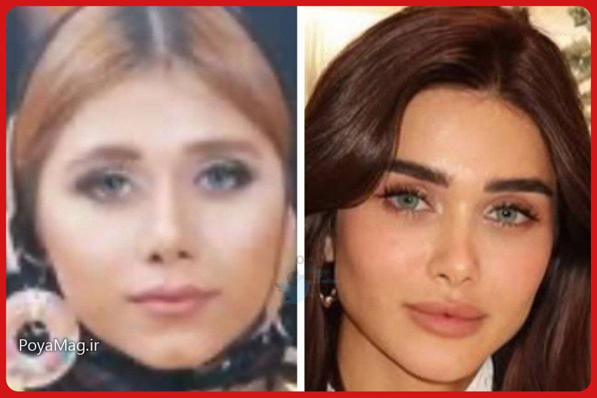 هیوا امین زیباترین زن خاورمیانه در سال ۲۰۲۵ شد/ عکس قبل و بعد از عمل زیبایی مدل ایرانی