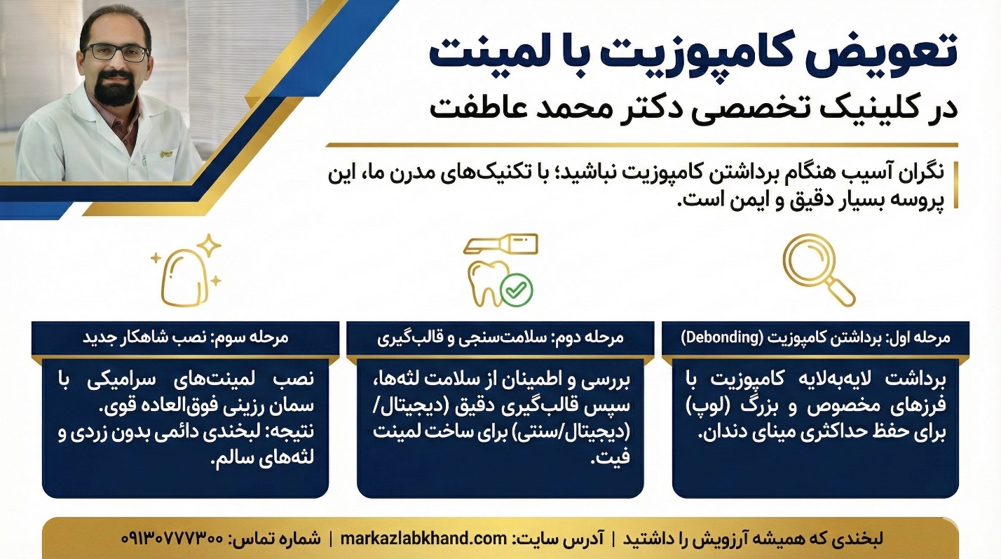 مراحل تعویض کامپوزیت با لمینت | متخصص لمینت دندان اصفهان
