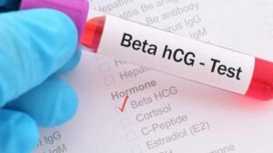 عدد بتا در بارداری و ارتباط آن با جنسیت نوزاد