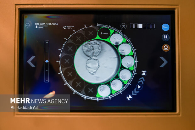 تأثیر مصرف دخانیات و الکل بر بارداری و موفقیت IVF تأثیر مصرف دخانیات و الکل بر بارداری و موفقیت IVF