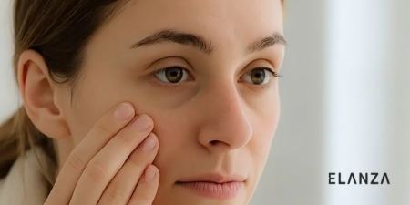 کرم دور چشم کرم دور چشم