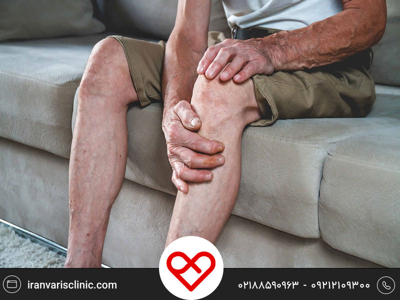 آشنایی با روش های موثر درمان واریس در سالمندان