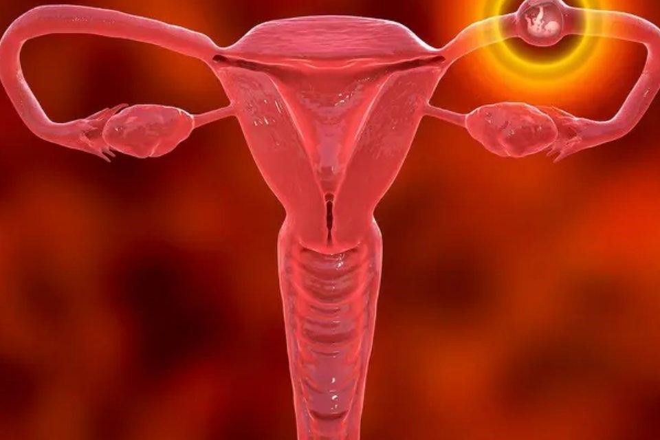 نشانه‌های هشداردهنده بارداری خارج از رحم که باید جدی بگیرید