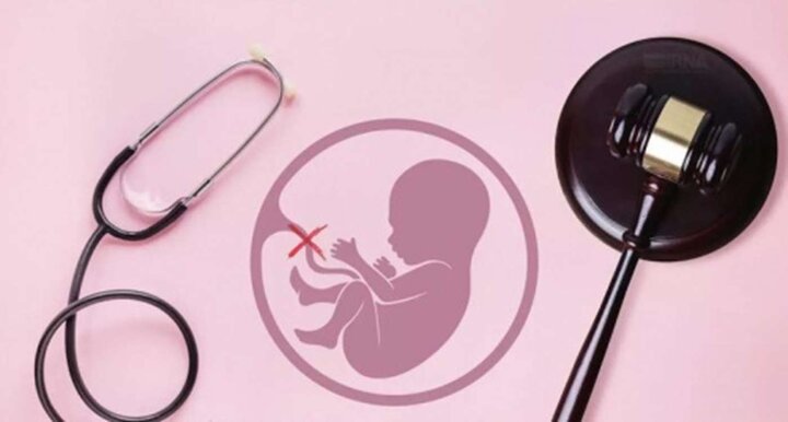 آمارهای سقط جنین غیرقانونی قابل اتکا نیست