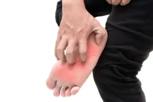 خارش کف پا؛ مشکل کوچک یا نشانه بیماری جدی؟