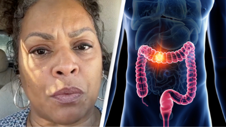 نشانه های پوستی سرطان روده بزرگ, علائم نادر پوستی سرطان کولورکتال