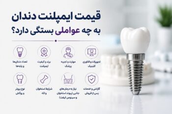 قیمت ایمپلنت دندان به چه عواملی بستگی دارد؟