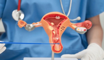 آیا سرطان رحم درمان قطعی دارد؟ بررسی علائم، علل و شانس بهبودی