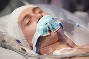 ضربه به سر ممکن است سلامت روده را مختل کند