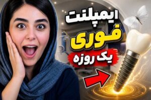 لبخند دوباره بدون درد و هزینه نجومی؛ بررسی معجزه ایمپلنت دیجیتال و فوری