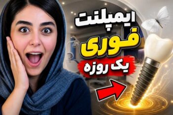 لبخند دوباره بدون درد و هزینه نجومی؛ بررسی معجزه ایمپلنت دیجیتال و فوری