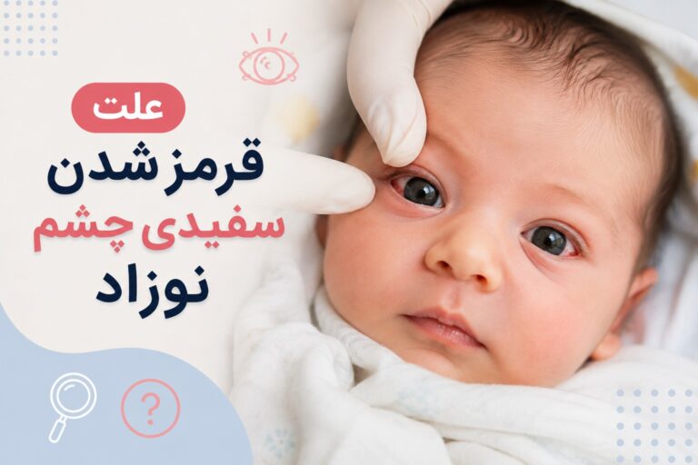 علت قرمز شدن سفیدی چشم نوزاد + علائم خطر و درمان