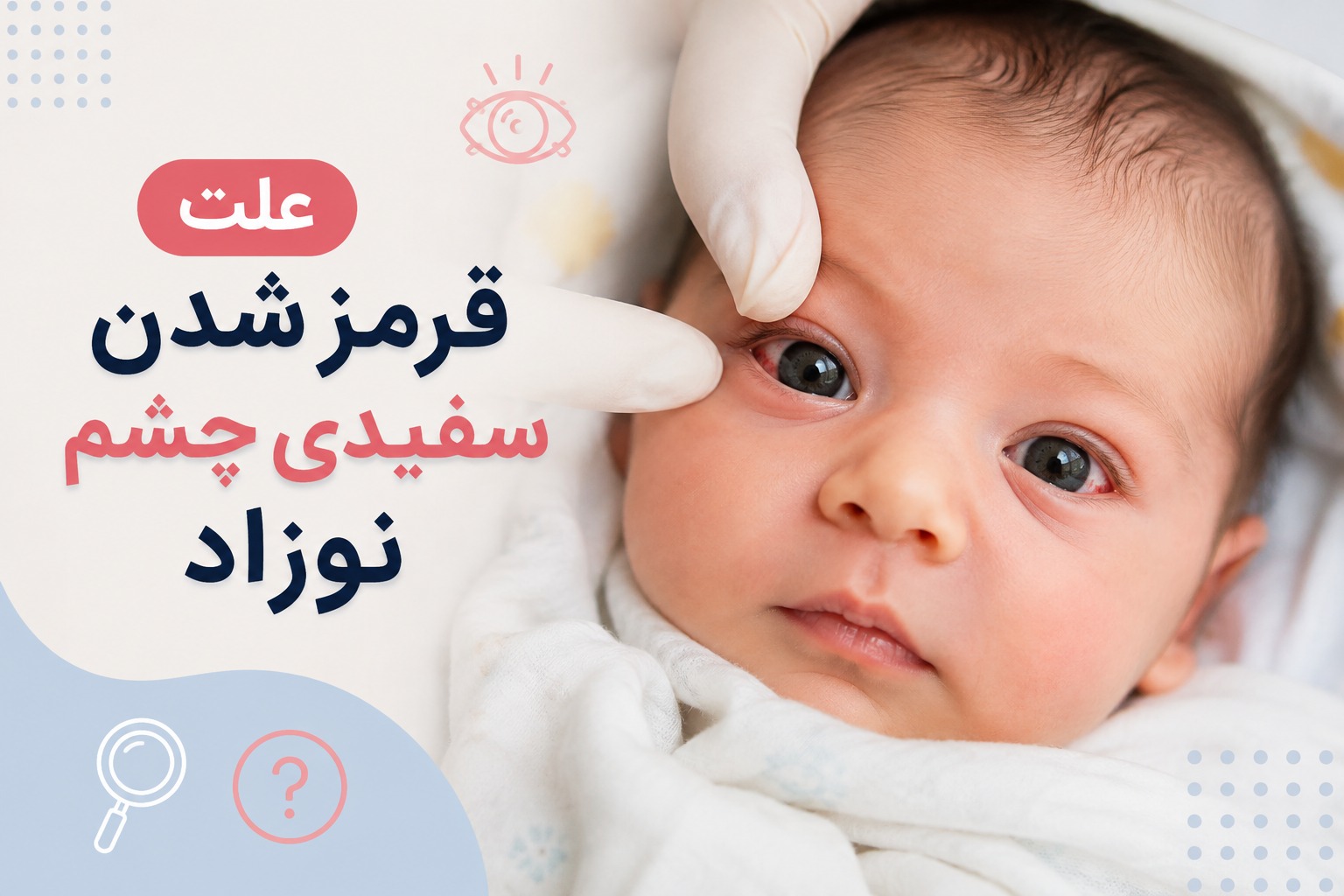 علت قرمز شدن سفیدی چشم نوزاد + علائم خطر و درمان