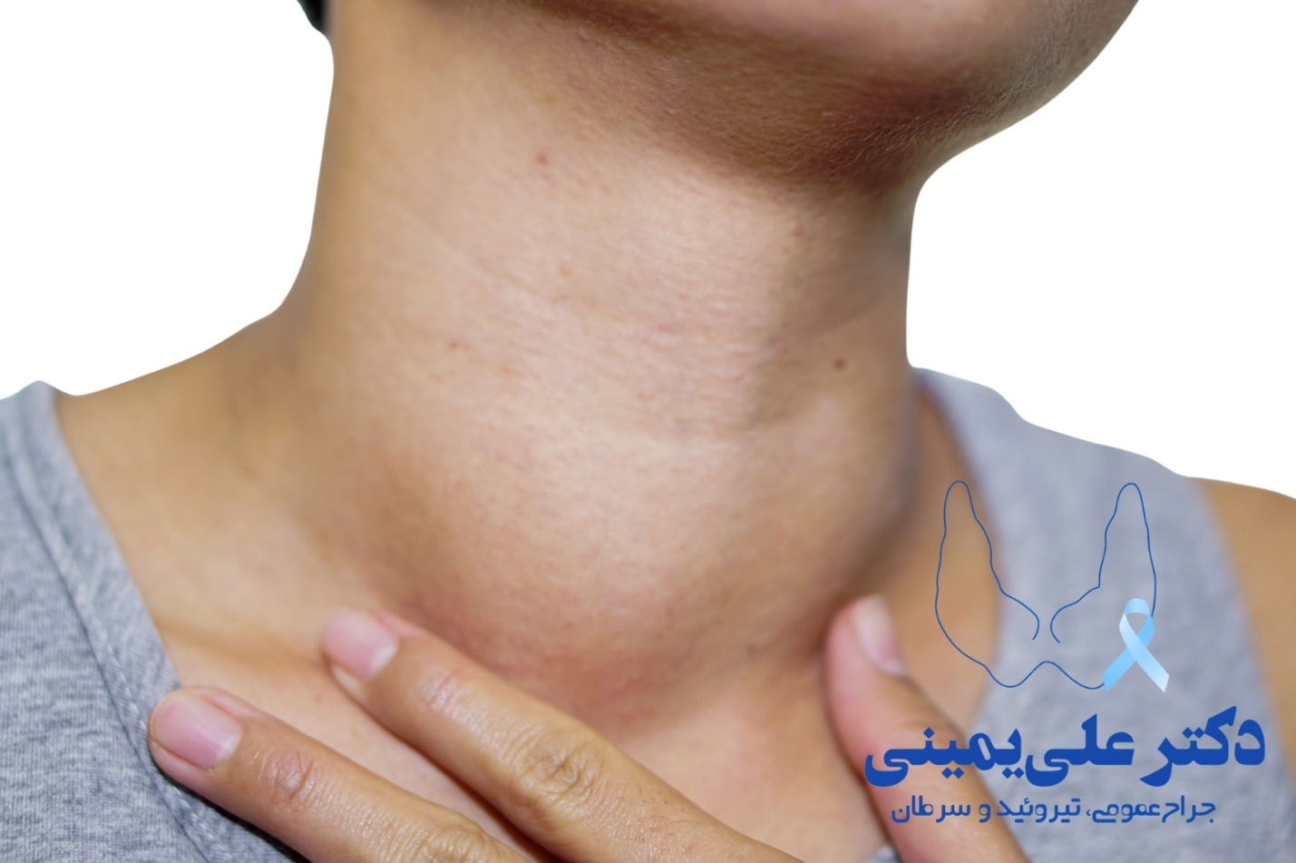 بیماریهای تیروئید و نقش جراح غدد؛ چه زمانی مسیر یک بیمار به سمت اتاق عمل میرود؟ گواتر؛ وقتی تیروئید بزرگتر از حد طبیعی میشود