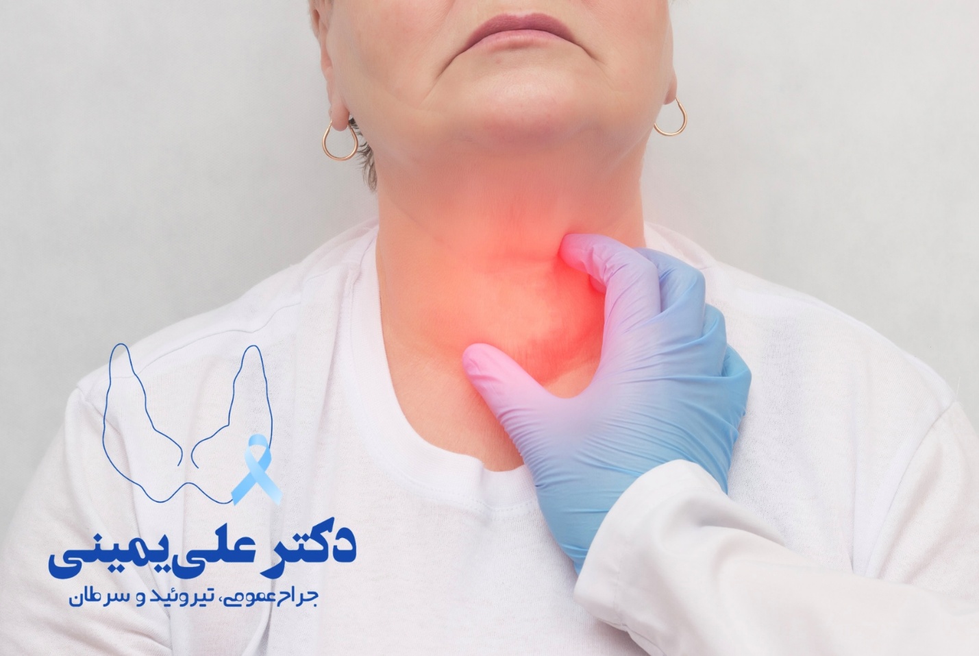 بیماریهای تیروئید و نقش جراح غدد؛ چه زمانی مسیر یک بیمار به سمت اتاق عمل میرود؟ ندول تیروئید