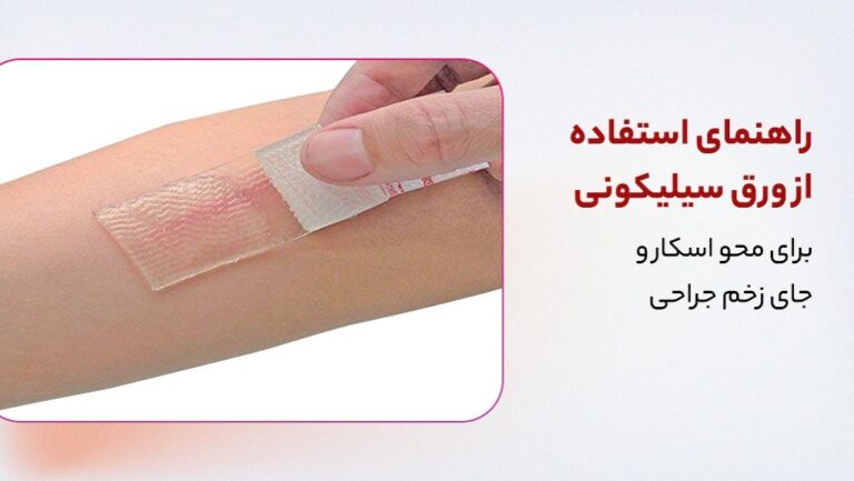 راهنمای استفاده از ورق سیلیکونی برای محو اسکار و جای زخم جراحی