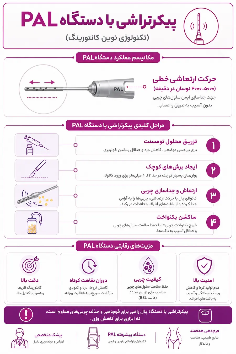 پیکرتراشی با دستگاه پال (PAL) چیست