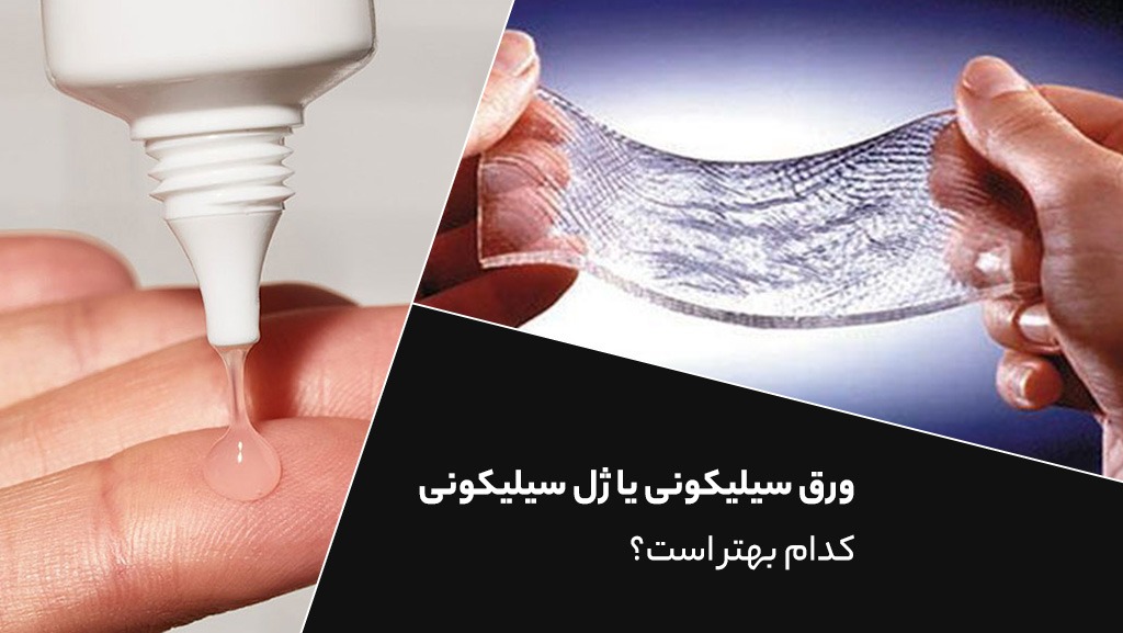 ورق سیلیکونی یا ژل سیلیکونی؛ کدام بهتر است؟